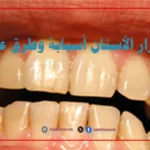 اصفرار الأسنان أسبابة وطرق علاجه