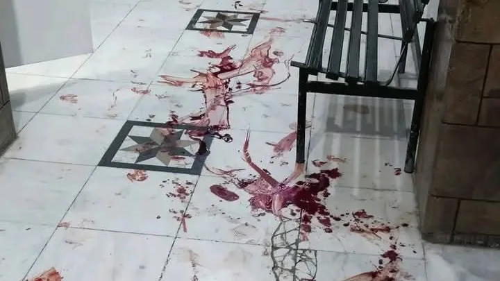 تعز: حملة أمنية تتحول إلى اشتباكات عنيفة داخل مستشفى الروضة