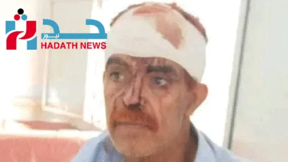 الشمايتين: زوجان يتعرضان لهجوم والجناة طلقاء