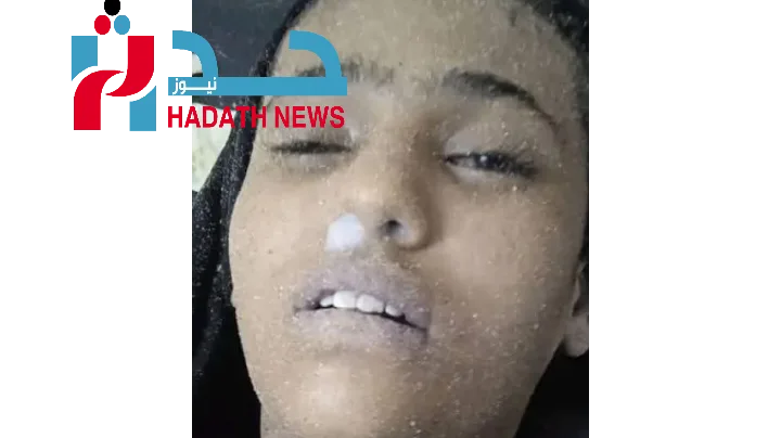 شابة مجهولة الهوية تصل متوفاة إلى مستشفى باصهيب بعد غرقها في ساحل جولد مور