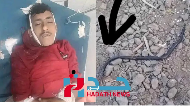 ثعبان أسود ينهي حياة شاب في المسراخ.. 3 دقائق فقط!