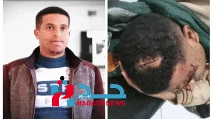 إصابة خطيرة للإعلامي محمد الحمادي إثر اعتداء مجهولين